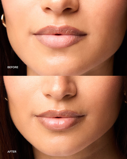 NORDH LIP TREATMENT